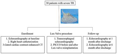 Hemodynamics of transcatheter tricuspid valve replacement with Lux-Valve